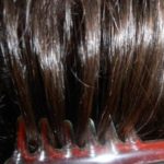 Дарсонваль для волос: польза применения, результаты, отзывы