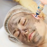 Карбоновый пилинг: новая методика лазерного омоложения кожи